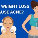 Does Weight Loss Cause Acne