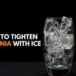 How To Tighten Virginia With Ice