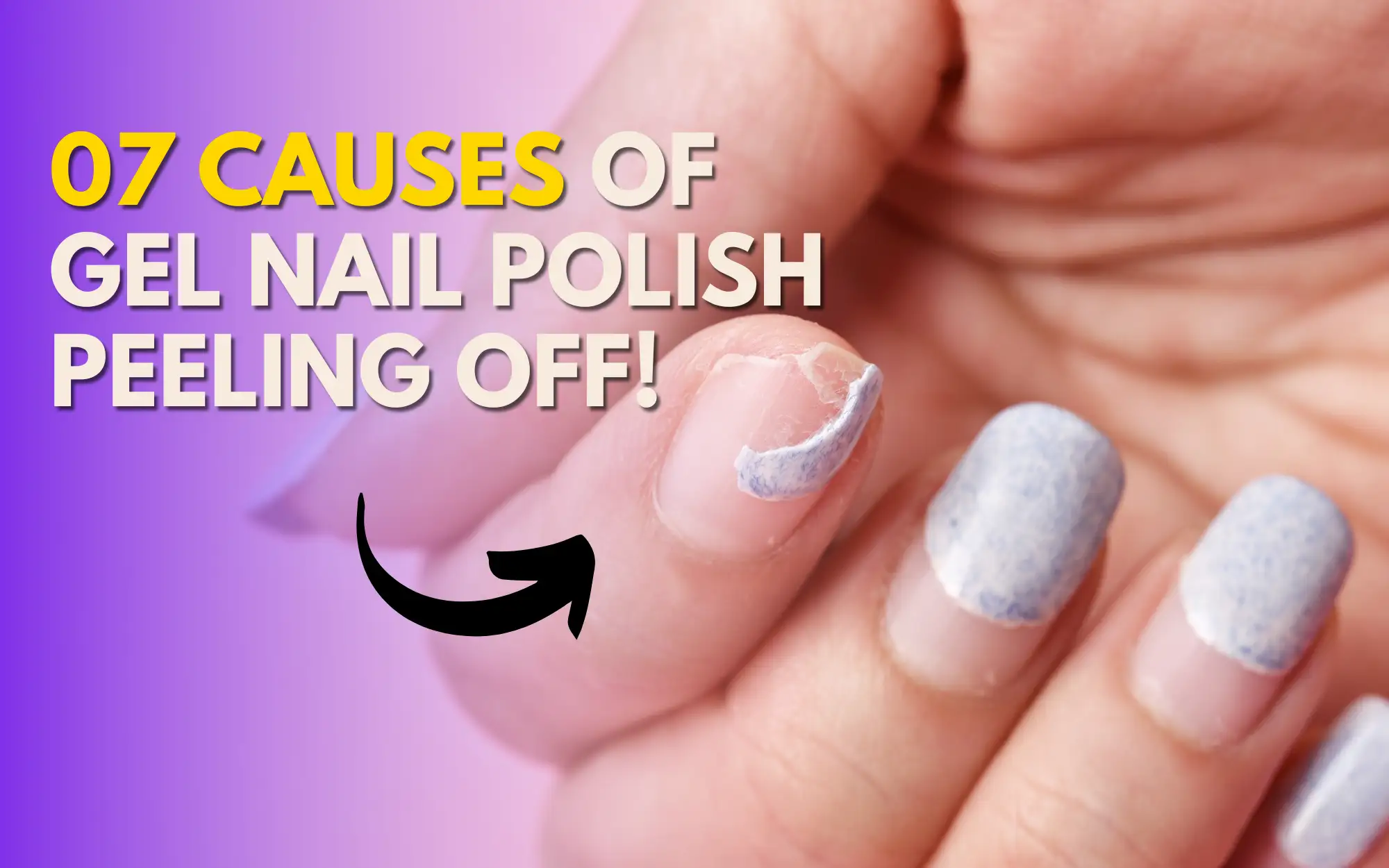 Why Does My Gel Nail Polish Peel Off Common Causes And Solutions